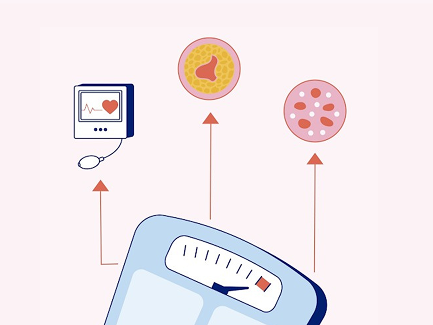 Значението на навременното и устойчиво намаляване на теглото