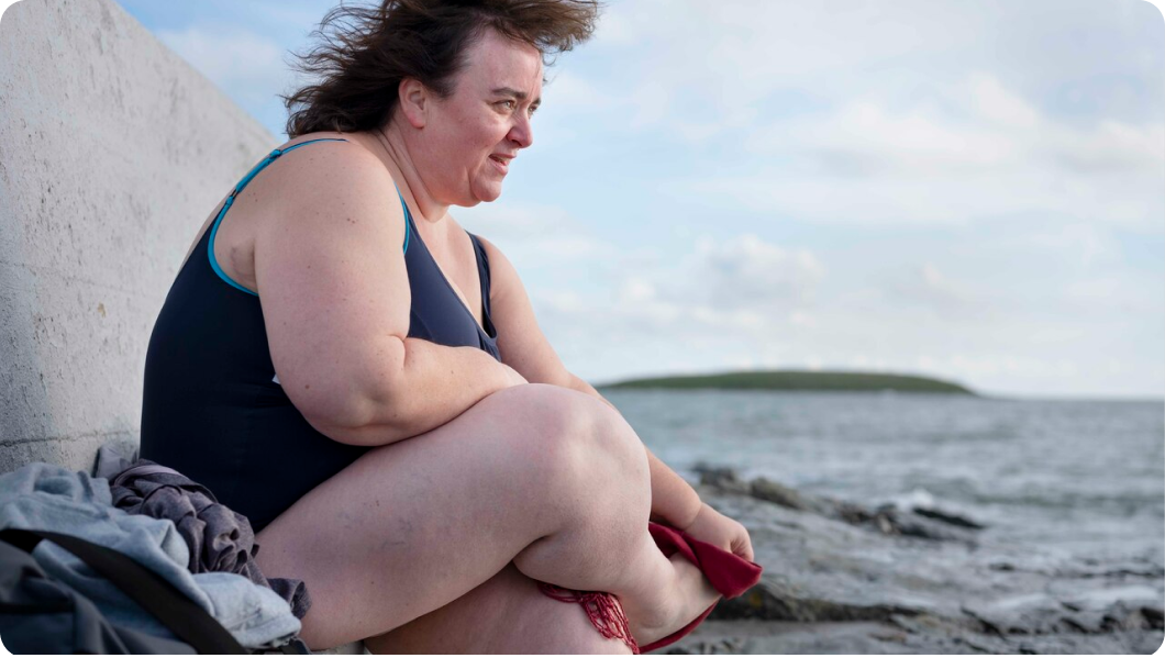 Obesity-in-Women-img1