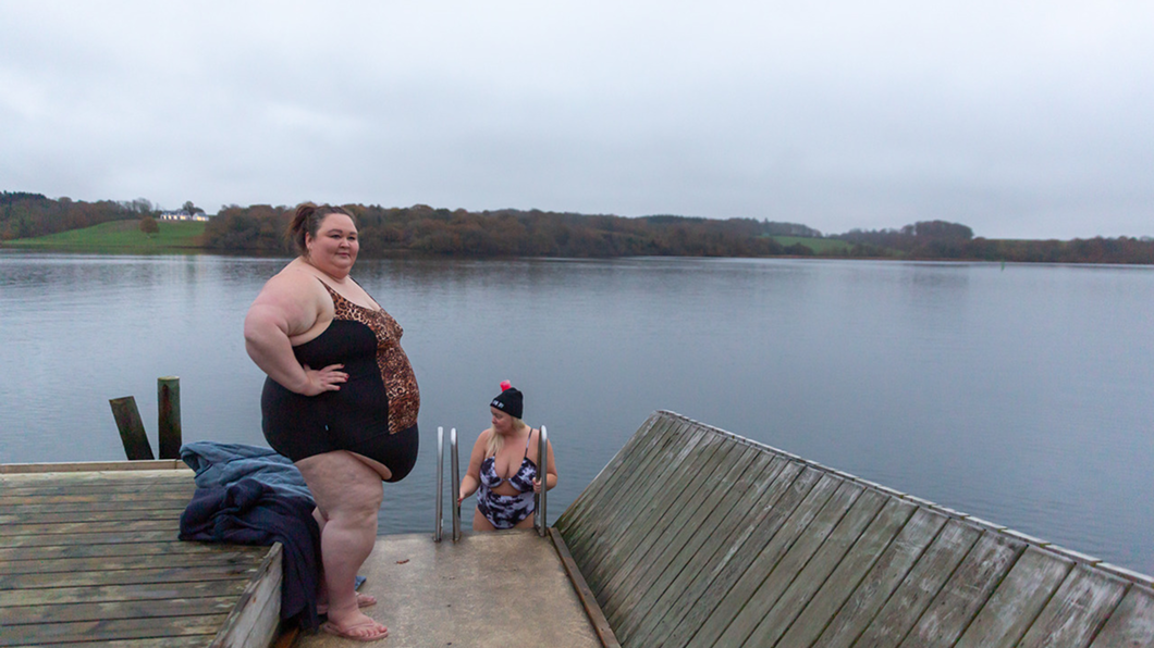 Surgery-for-obesity-banner