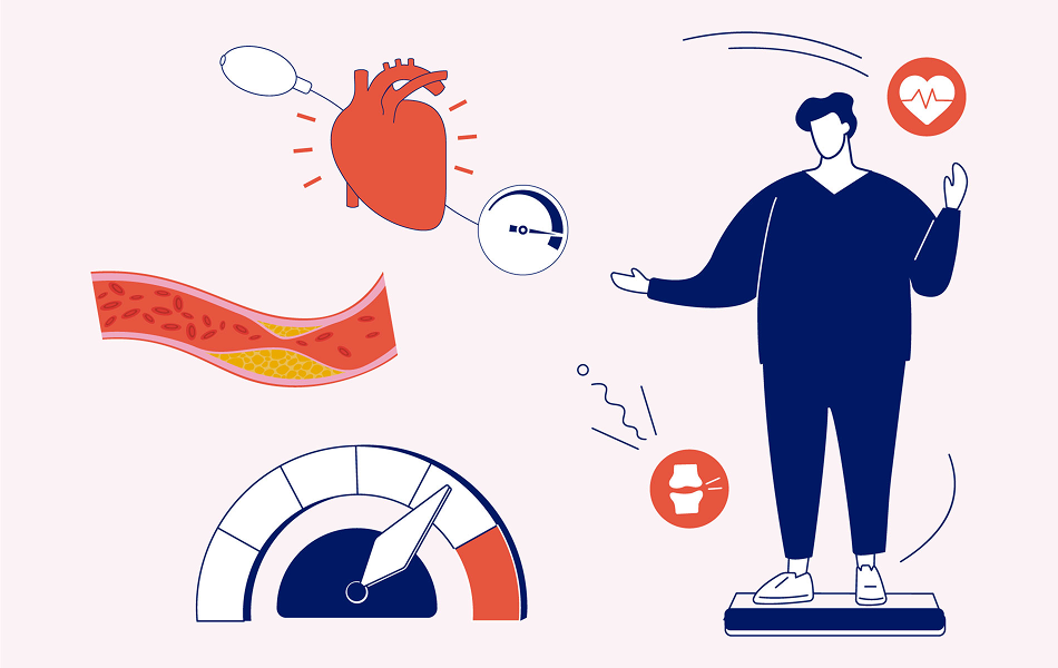 Complicaciones cardiovasculares y la obesidad